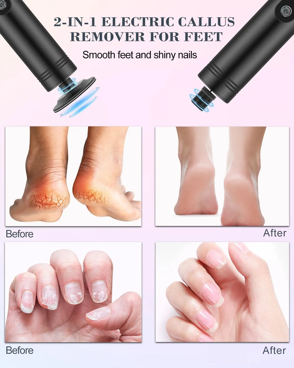 Electric Foot Callus Remover with Nano-Glass Head, 2000mAh Rechargeable Battery and LED Display, Foot File Callus Remover with Replaceable Sandpaper Discs, for Callus Removal and Nail Care, Black