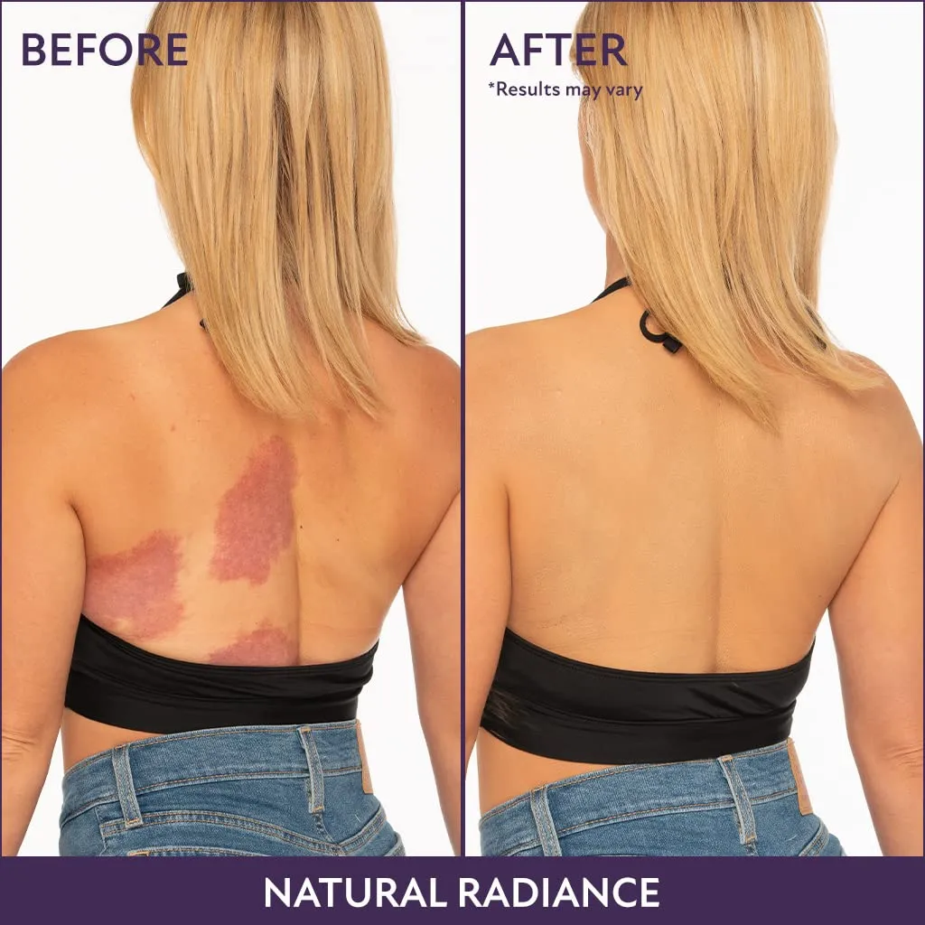 Westmore Beauty Body Coverage Perfector – Waterproof Leg & Body Makeup - Tattoo Cover Up Makeup - 7 Oz (Warm Radiance)