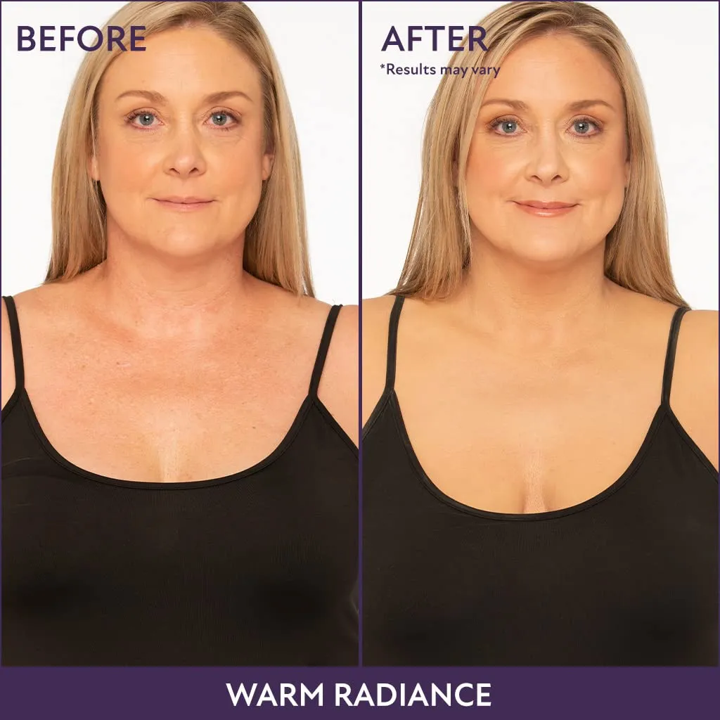 Westmore Beauty Body Coverage Perfector – Waterproof Leg & Body Makeup - Tattoo Cover Up Makeup - 7 Oz (Warm Radiance)
