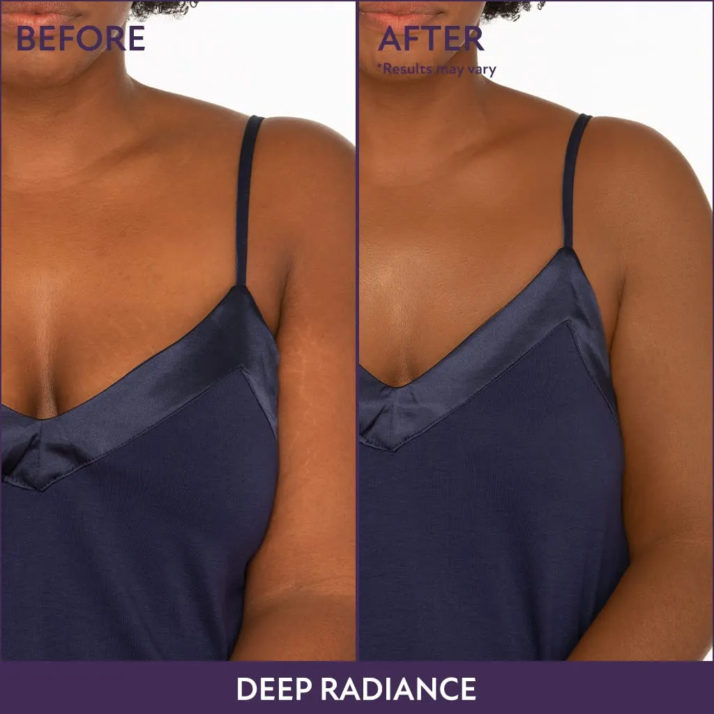 Westmore Beauty Body Coverage Perfector – Waterproof Leg & Body Makeup - Tattoo Cover Up Makeup - 7 Oz (Warm Radiance)